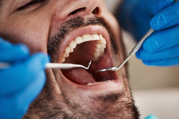 Tooth Infection Emergency Dentist in NJ